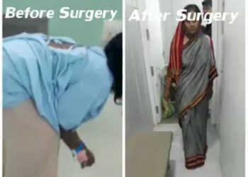 गजानन लोकसेवा हॉस्पिटलमध्ये ‘मणक्याच्या टी.बी’वर किचकट शस्त्रक्रिया यशस्वी; पलंगावर झोपून असलेला पेशंट चालू लागला