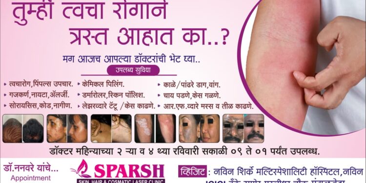 तुम्ही त्वचा रोगाने त्रस्त आहात का? महिन्याच्या दुसऱ्या व चौथ्या रविवारी प्रसिद्ध त्वचारोग तज्ञ डॉक्टर शिर्के मल्टीस्पेशालिटी हॉस्पिटलमध्ये